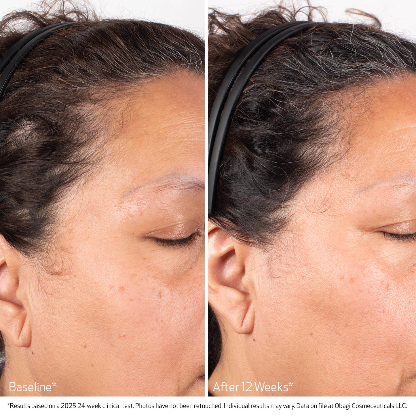 Obagi Nucil BIOSTIM™ SCALP SERUM