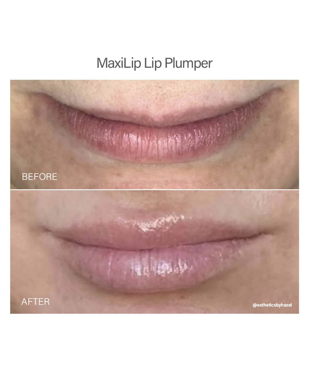 Vivant MAXILIP LIP PLUMPER