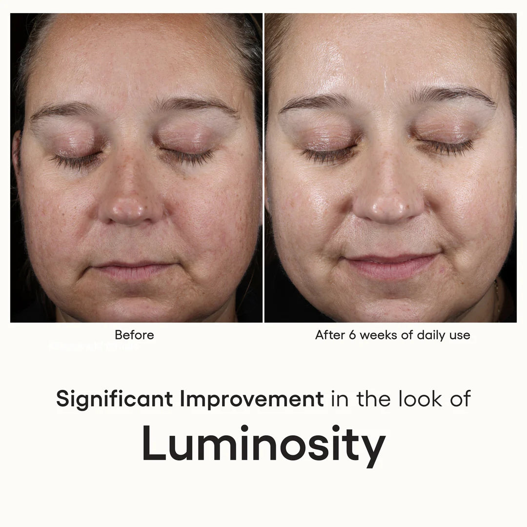 ( plated ) Intense Serum *NEW
