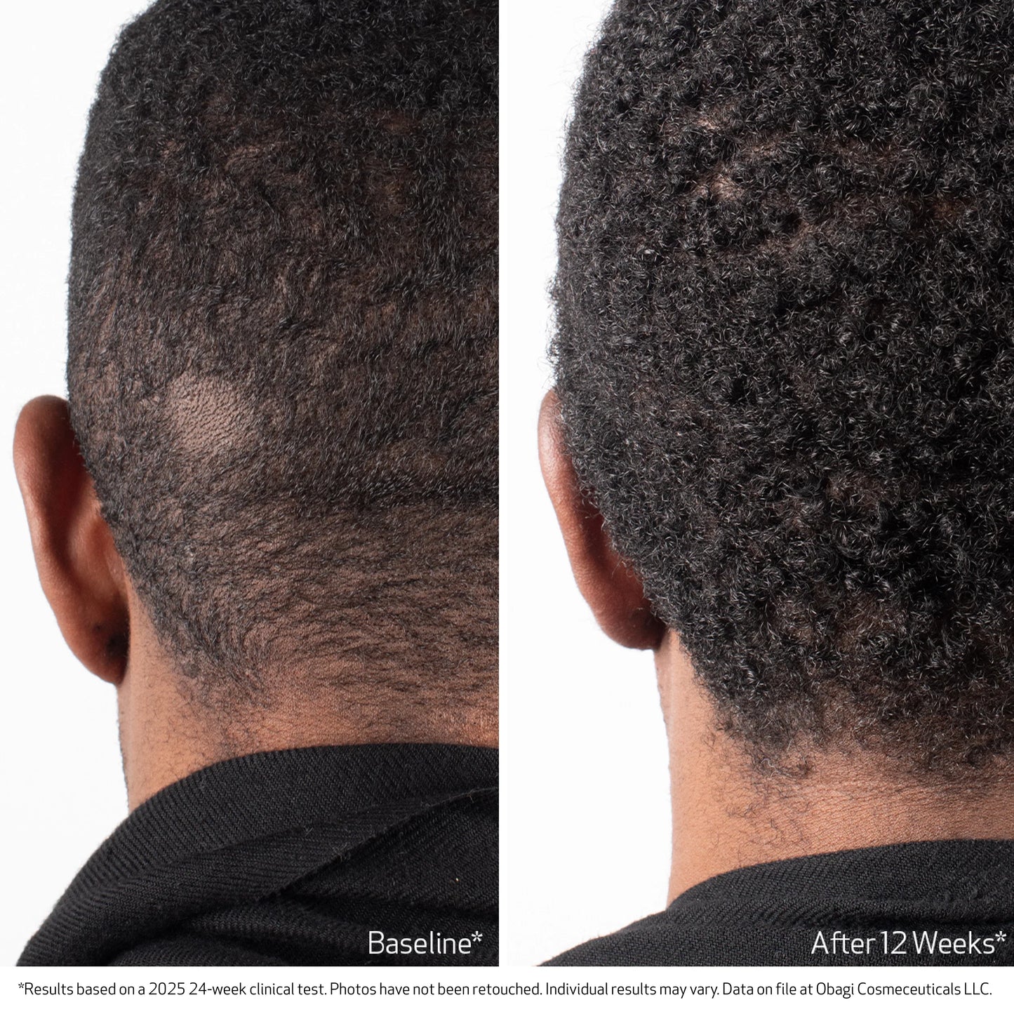 Obagi Nucil BIOSTIM™ SCALP SERUM